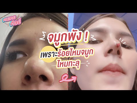 ร้อยไหม หน้าเรียว
