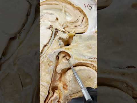 How You “Pop” Your Ears! | #shorts #ears