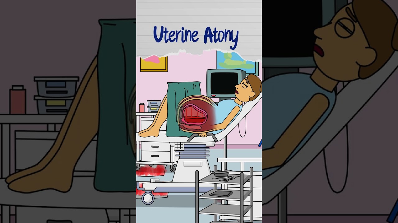 Postpartum Hemorrhage Mnemonic | OBGYN High-Yield | USMLE Step 2 & Shelf Review