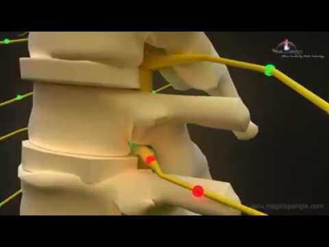 How Chiropractic works