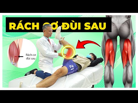 Cơn Ác Mộng Rách Cơ Đùi Sau: Làm Sao Để Vượt Qua?