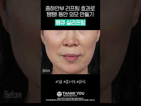땡큐성형외과 Clips