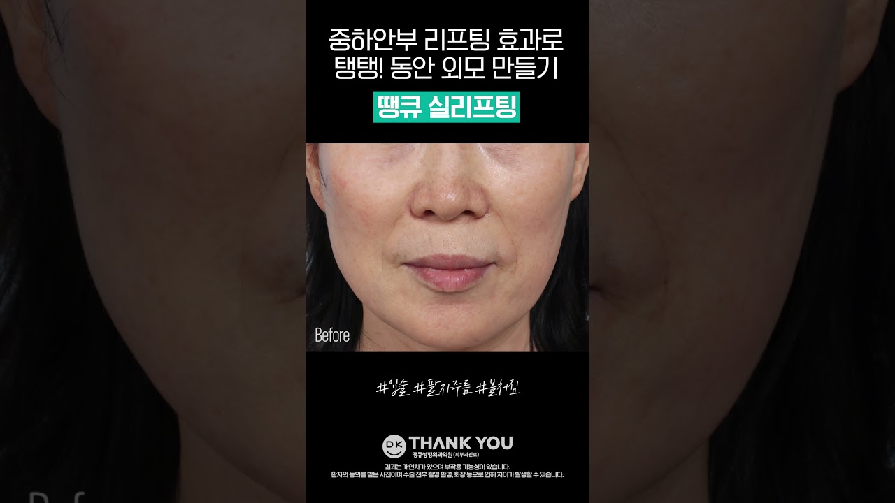 땡큐성형외과 Clips