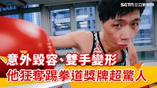 意外毀容雙手變形　他狂奪踢拳道獎牌超驚人