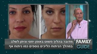 ד"ר אבישי וינברגר מדבר על יתרונות טיפול ה-U-Facelift על פני מתיחת פנים קלאסית