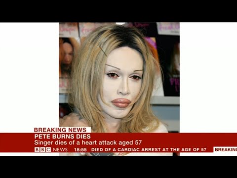 2016.10.23📺Pete Burns Died BBC NEWS