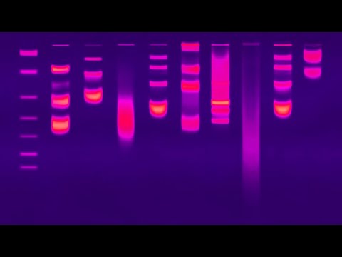 Gel Electrophoresis