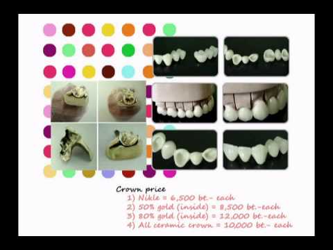 Dental Point Pattaya Presentation VDO Clip
