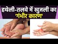 सर्दियों में हथेली तलवे में खुजली क्य�