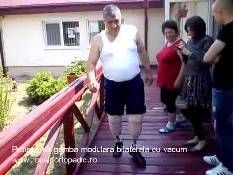 Proteza de gamba modulara bilaterala cu vacum - Rosal Ortopedic
