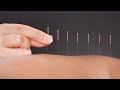 The Science Behind How Acupuncture Helps Relieve Pain: A Doctor Of Chinese Medicine Explains