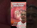 How To Treat An Abscess Baby Tooth In Office To Hands On Dental Training Shorts