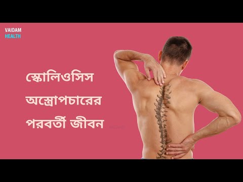 স্কোলিওসিস অস্ত্রোপচারের পরর্বতী জীবন