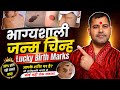 Birth Mark Astrology Janm Chinh Birth Mark Indicates Birth Mark On Body Birth Mark Facts
