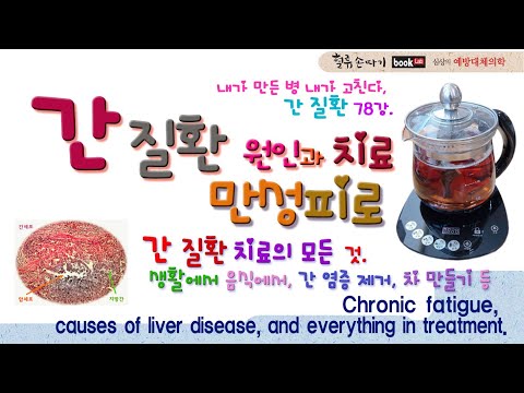 , title : '간질환 78강. 만성피로와 간 질환의 원인과 치료법. Chronic fatigue, causes of liver disease, and everything in treatment.'