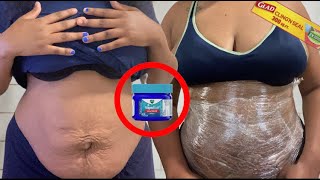 How To: Wrap your Stomach Using Vicks Vapor Rub to Reduce Belly Fat FAST