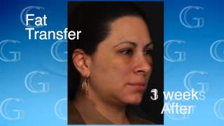 Glasgold Group Plastic Surgery