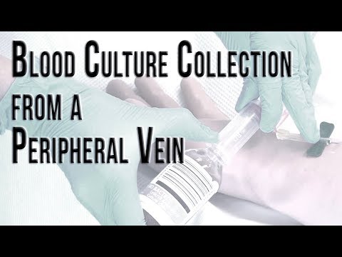 Blood Culture Collection from a Peripheral Vein