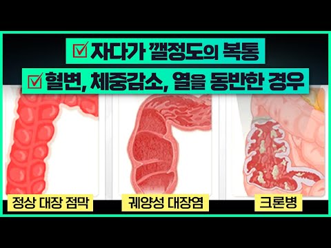 영상 썸네일