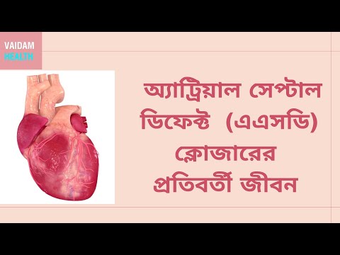 আট্রিয়াল সেপ্টাল ডিফেক্ট ক্লোজারের পরবর্তী জীবন