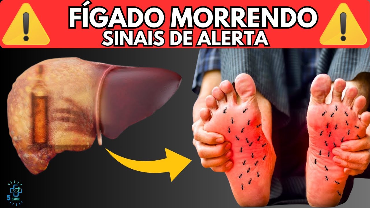 Fígado em Perigo! 10 Sintomas Secretos de um Fígado Danificado que Você Ignora
