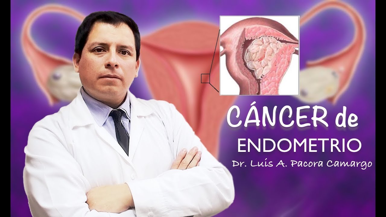 SANGRADO VAGINAL EN LA MENOPAUSIA ❗Cuidado ⚠️ con el CÁNCER DE ENDOMETRIO