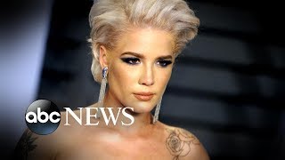 Halsey says she will freeze her eggs at 23 because of endometriosis
