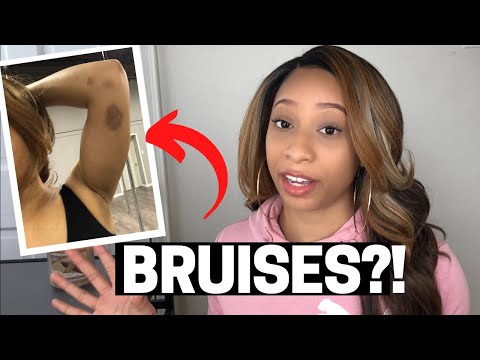 YouTube video about: How do pole dancers not get burned?