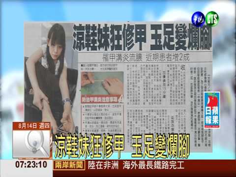 涼鞋妹狂修甲 玉足變爛腳