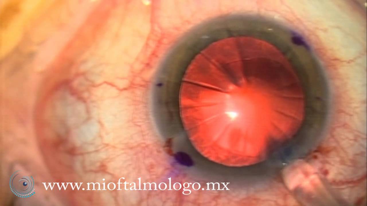 Elena Turrion Salmeron-5