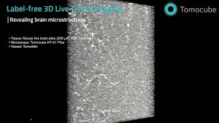 Brain Microstructures - Label-free 3D Live Tissue Imaging