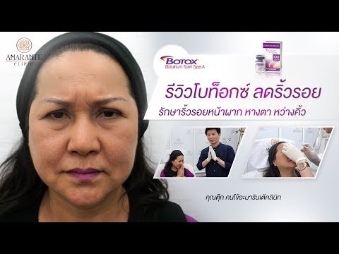 โบท็อก ลดริ้วรอย