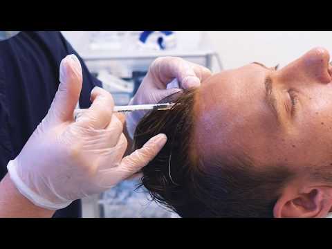 Seuraa potilasta PRP-hoidon aikana