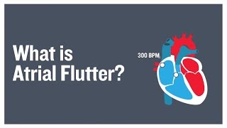 What is atrial flutter?