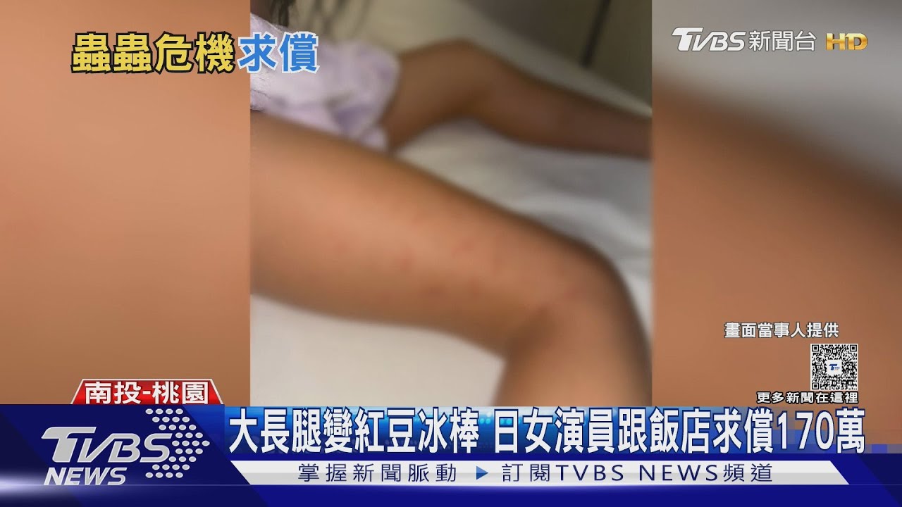 日女星親子遊台染床蝨!「紅疹纏身2週」 飯店回應了