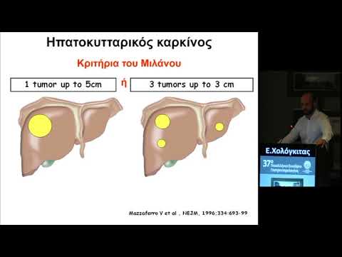 Χολόγκιτας Ευάγγελος - Ενδείξεις μεταμόσχευσης ήπατος