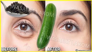 Put it under eyes🥒and the result will amaze you, Charming eyes without dark circles or puffiness