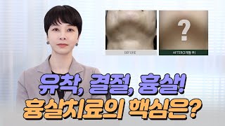 이중턱 지방흡입 흉살! 딱딱하게 자리잡은 유착, 결절 부작용 치료 전후 공개!