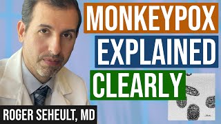 Monkeypox Explained Clearly