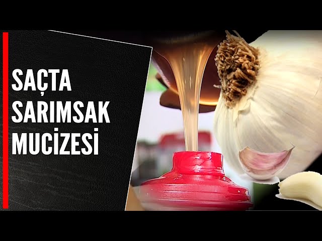 Sarimsak Sac Cikarir Mi Iste Mucizevi Cozum Nefis Yemek Tarifleri