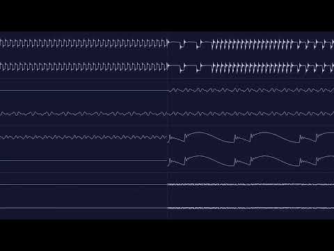 [TSU cover] Tim Follin - Solstice (NES) - Title Theme