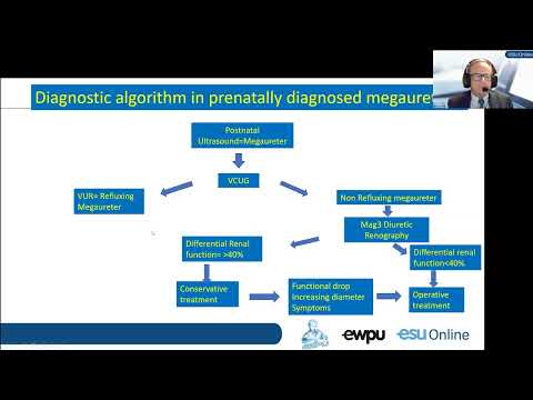 UROwebinar Megaureter - A focus on patient selection and long-term care