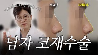 뾰족하고 인위적인 남자 코 재수술! 콧대와 코끝 라인 교정 3개월 경과 코성형 케이스리뷰 (귀연골 + 기증근막)