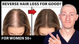How To STOP Menopausal Hair Loss