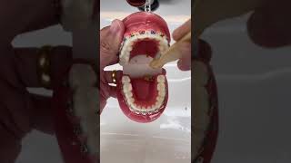 How to Brush your teeth when you have Braces on #braces #brush