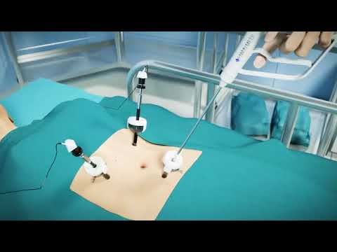 Fixation Device for Hernia Repair  (EZ-Tacker-Manual)