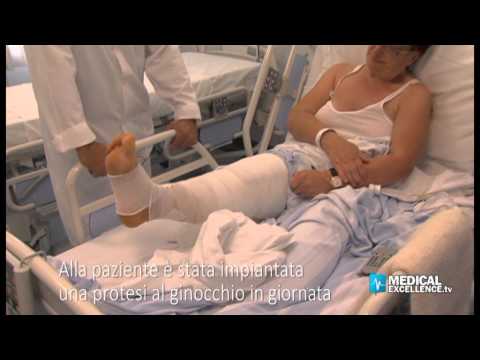 Medicina tradizionale da unernia cervicale Quale laccusa dellarticolazione della spalla
