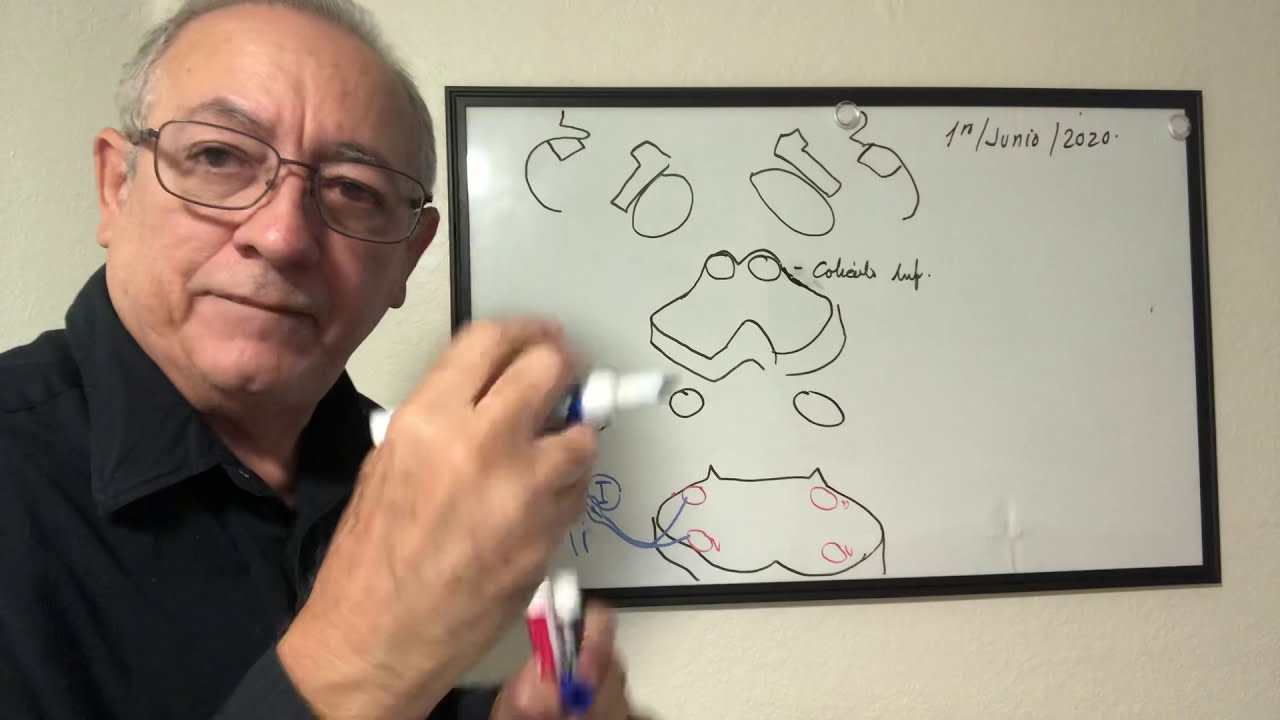 Vía Auditiva, estructuras y neuronas que participan, curiosidades. VIII nervio craneal