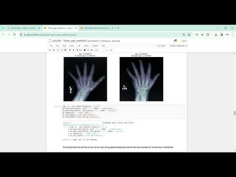 Bone Age Prediction in Python Projects