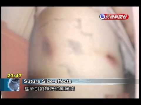 Magnetic singsing para sa slimming daliri Gym upang mawala ang timbang sa mga batang babae review